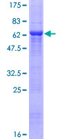 12.5% SDS-PAGE Stained with Coomassie Blue.